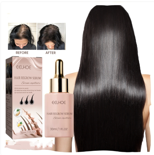 EELHOE Hair Growth Essence – Anti Hair Loss & Strengthening Serum 30ml